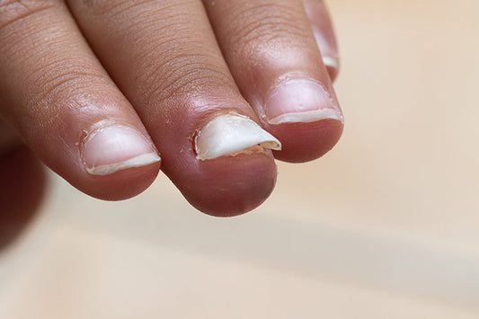 How to Avoid Nail Fungus with Press on Nails: A Comprehensive Guide